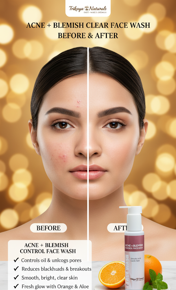 Acne & Blemish Clear Face Wash for Gentle Cleansing & Balanced Skin Care